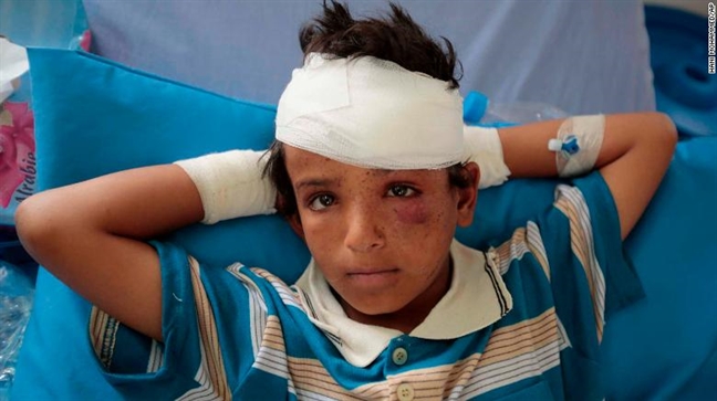 Thảm kịch không kích nhầm tại Yemen: Những tiếng cười cuối cùng trước khi bom nổ Tham kich khong kich nham tai Yemen: Nhung tieng cuoi cuoi cung truoc khi bom no