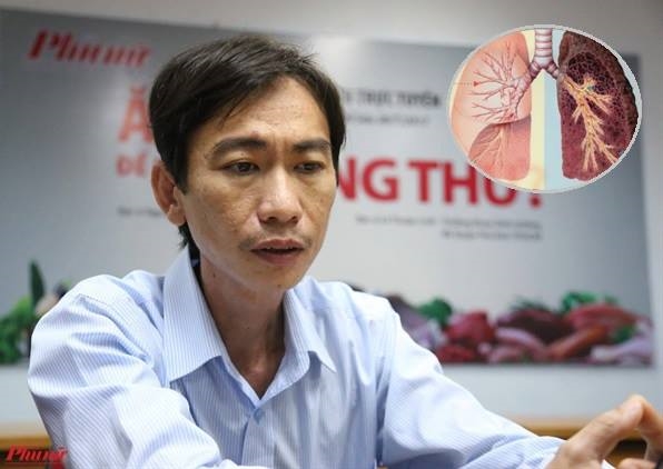 Cách phát hiện ung thư phổi sớm Cach phat hien ung thu phoi som