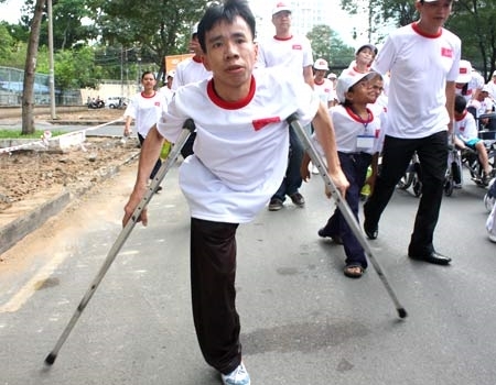 30 năm mổ tách cặp song sinh Việt - Đức: Niềm vui như mới ngày hôm qua 30 nam mo tach cap song sinh Viet - Duc: Niem vui nhu moi ngay hom qua