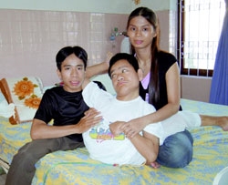 30 năm mổ tách cặp song sinh Việt - Đức: Niềm vui như mới ngày hôm qua 30 nam mo tach cap song sinh Viet - Duc: Niem vui nhu moi ngay hom qua