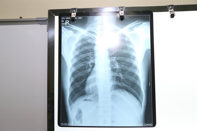 Nam bệnh nhân có 'lục phủ ngũ tạng' đảo lộn hoàn toàn so với người thường Nam benh nhan co 'luc phu ngu tang' dao lon hoan toan so voi nguoi thuong