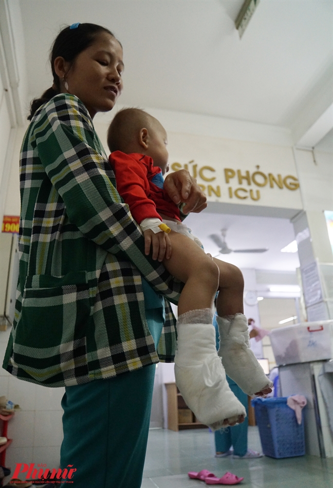 Nhiều trẻ không được ăn tết do phỏng Nhieu tre khong duoc an tet do phong