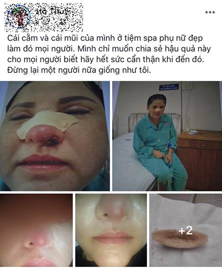 Nhân viên thẩm mỹ viện bị biến chứng do đưa mặt cho chủ tiệm ‘đập đi xây lại’ Nhan vien tham my vien bi bien chung do dua mat cho chu tiem ‘dap di xay lai’