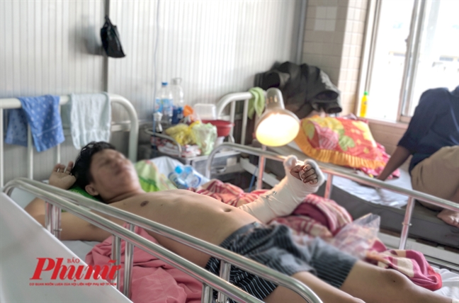 Cuối năm, nhiều người phải vào bệnh viện nối lại chi bị đứt lìa Cuoi nam, nhieu nguoi phai vao benh vien noi lai chi bi dut lia
