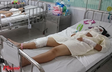Trẻ phỏng ngày tết, nỗi đau kéo dài đến nhiều năm sau Tre phong ngay tet, noi dau keo dai den nhieu nam sau