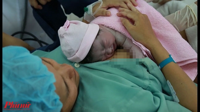 Tưởng bị lão thị, đau bao tử, nhiều thai phụ suýt chết vì tiền sản giật Tuong bi lao thi, dau bao tu, nhieu thai phu suyt chet vi tien san giat