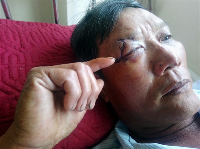 Dân đổ máu vì 'cát tặc' hoành hành Dan do mau vi 'cat tac' hoanh hanh