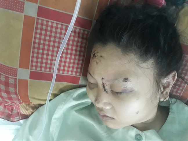 Làm rõ vụ người phụ nữ bị tra tấn đến sảy thai 6 tháng tuổi Lam ro vu nguoi phu nu bi tra tan den say thai 6 thang tuoi
