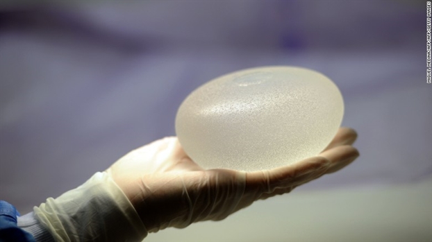 FDA cho phép bán túi nâng ngực bị tố liên quan đến ung thư FDA cho phep ban tui nang nguc bi to lien quan den ung thu