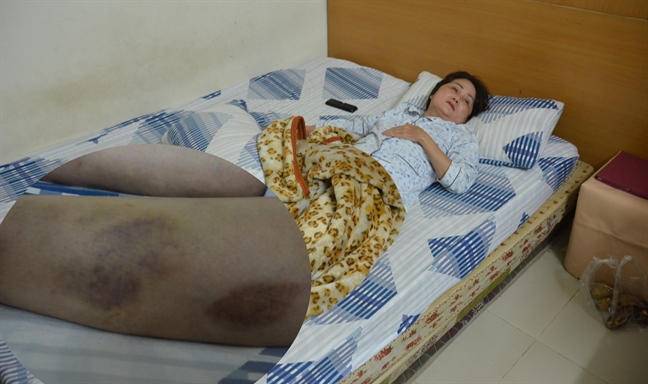 Ngăn người lạ vào nhà hàng xóm, hai phụ nữ bị đánh nhập viện Ngan nguoi la vao nha hang xom, hai phu nu bi danh nhap vien