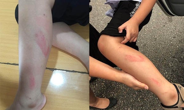 Không thể 'hãm cơn điên' thì đừng làm giáo viên Khong the 'ham con dien' thi dung lam giao vien