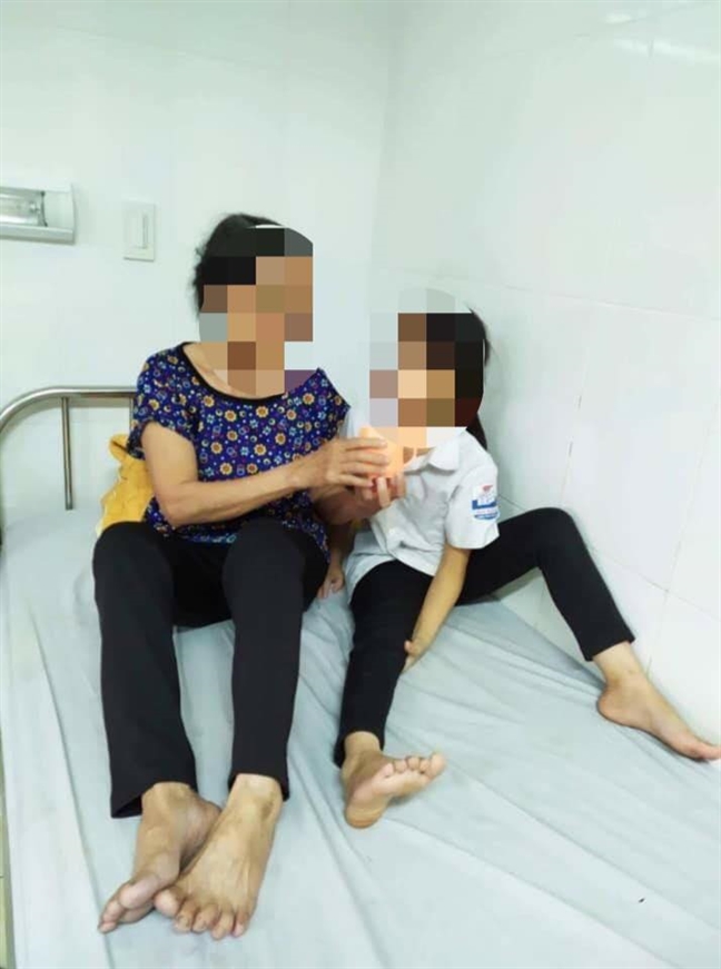 Bị trâu nhà nuôi húc nát mặt, bé gái 9 tuổi gãy xương hàm Bi trau nha nuoi huc nat mat, be gai 9 tuoi gay xuong ham