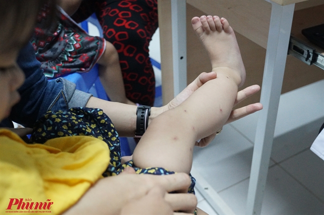 Thời tiết chuyển mùa, nhiều trẻ nguy kịch do viêm cơ tim nhưng cứ ngỡ cảm sốt Thoi tiet chuyen mua, nhieu tre nguy kich do viem co tim nhung cu ngo cam sot