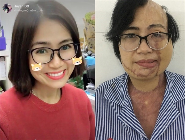 Tạt axit hủy hoại vợ vì ghen: tận cùng cái ác! Tat axit huy hoai vo vi ghen: tan cung cai ac!