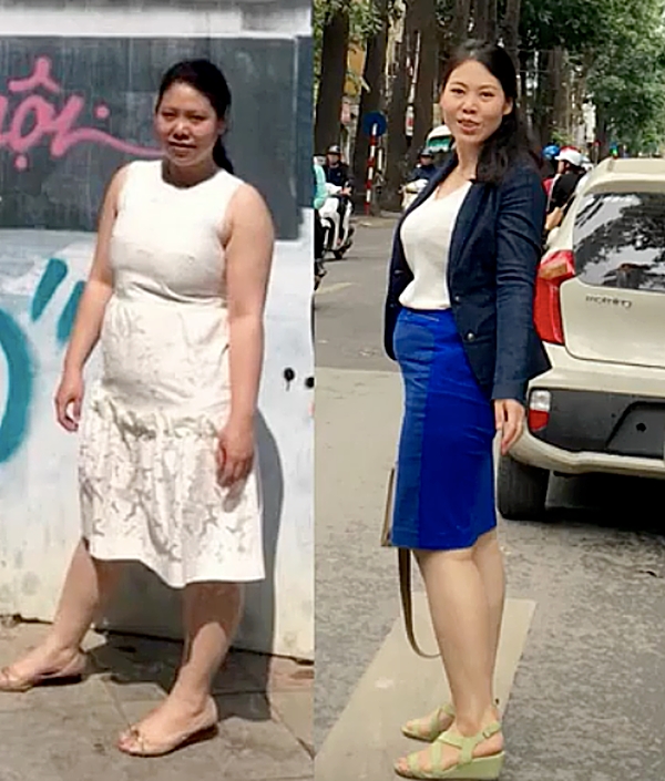 Cắt bớt dạ dày để giảm béo cho cô gái có phủ tạng đảo ngược Cat bot da day de giam beo cho co gai co phu tang dao nguoc