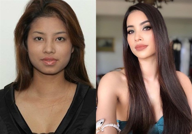 Loạt sao Việt 'lên hương' nhan sắc nhờ 'dao kéo' Loat sao Viet 'len huong' nhan sac nho 'dao keo'