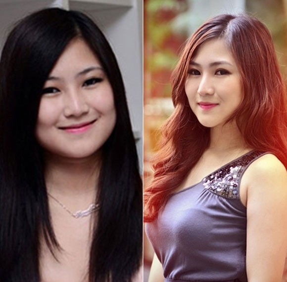 Loạt sao Việt 'lên hương' nhan sắc nhờ 'dao kéo' Loat sao Viet 'len huong' nhan sac nho 'dao keo'