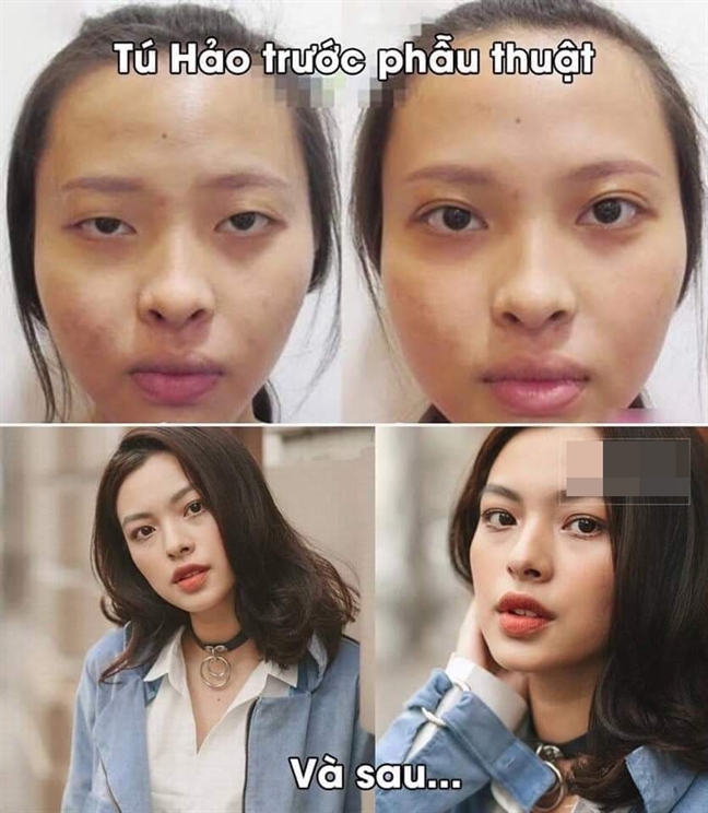 Loạt sao Việt 'lên hương' nhan sắc nhờ 'dao kéo' Loat sao Viet 'len huong' nhan sac nho 'dao keo'