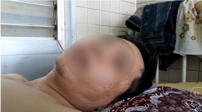 Bệnh viện Chợ Rẫy xác nhận nhầm lẫn khoan cẳng chân cho bệnh nhân gãy đốt sống ngực Benh vien Cho Ray xac nhan nham lan khoan cang chan cho benh nhan gay dot song nguc