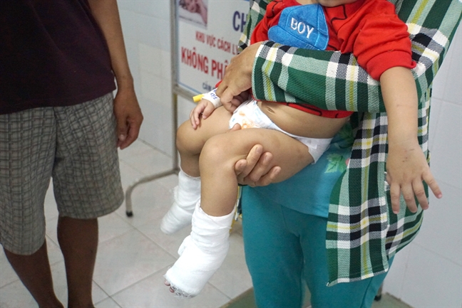 Những tai nạn đáng sợ trong mùa hè Nhung tai nan dang so trong mua he