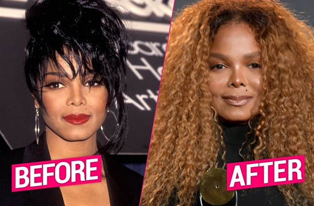 Mặt ngày càng biến dạng, em gái Michael Jackson có nối gót anh trai? Mat ngay cang bien dang, em gai Michael Jackson co noi got anh trai?