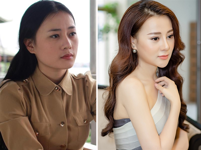 Những chiếc cằm dài ngoằng của sao Việt Nhung chiec cam dai ngoang cua sao Viet
