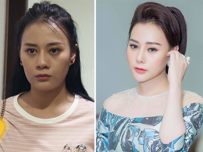 Những chiếc cằm dài ngoằng của sao Việt Nhung chiec cam dai ngoang cua sao Viet