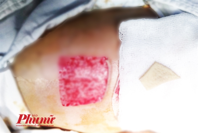 Vì sao TP.HCM đề xuất bác sĩ người nước ngoài phải biết tiếng Việt khi khám bệnh cho người Việt? Vi sao TP.HCM de xuat bac si nguoi nuoc ngoai phai biet tieng Viet khi kham benh cho nguoi Viet?