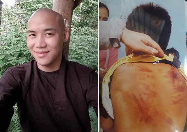 Bé trai bị người tu tại gia bạo hành phải điều trị về thần kinh Be trai bi nguoi tu tai gia bao hanh phai dieu tri ve than kinh