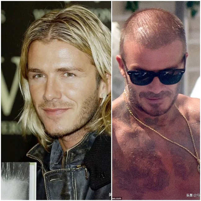 David Beckham, Ben Affleck… than trời vì hói đầu David Beckham, Ben Affleck… than troi vi hoi dau