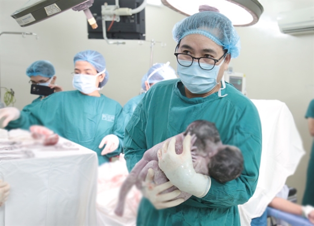 Bác sĩ ‘vẽ đường’ mổ hình miệng cười, cứu song thai dính chung phần gan trong bụng mẹ Bac si ‘ve duong’ mo hinh mieng cuoi, cuu song thai dinh chung phan gan trong bung me