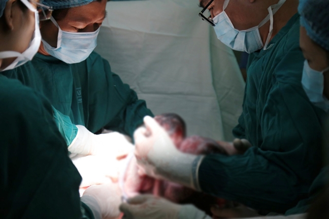 Bác sĩ ‘vẽ đường’ mổ hình miệng cười, cứu song thai dính chung phần gan trong bụng mẹ Bac si ‘ve duong’ mo hinh mieng cuoi, cuu song thai dinh chung phan gan trong bung me