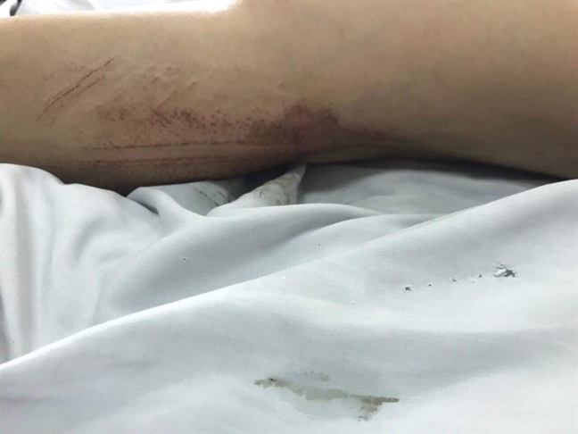 Nghi vấn người phụ nữ bị chồng cũ đánh đập, dùng ô tô đâm ép vào tường Nghi van nguoi phu nu bi chong cu danh dap, dung o to dam ep vao tuong