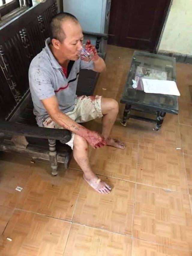 Đau lòng những vụ án huynh đệ tương tàn do tranh chấp đất đai Dau long nhung vu an huynh de tuong tan do tranh chap dat dai