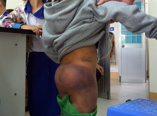Đưa 4 học sinh tiểu học nghi bị bạo hành vào trung tâm bảo trợ xã hội Dua 4 hoc sinh tieu hoc nghi bi bao hanh vao trung tam bao tro xa hoi