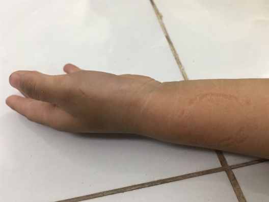 Bị bé gái 3 tuổi nhận diện 'người làm con đau' vùng kín, ông già 71 tuổi vẫn thoát tội Bi be gai 3 tuoi nhan dien 'nguoi lam con dau' vung kin, ong gia 71 tuoi van thoat toi