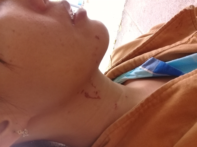Chồng đánh, dìm vợ xuống nước như cố giết: 'Chưa thấy chồng nào đánh vợ tàn độc như thế' Chong danh, dim vo xuong nuoc nhu co giet: 'Chua thay chong nao danh vo tan doc nhu the'
