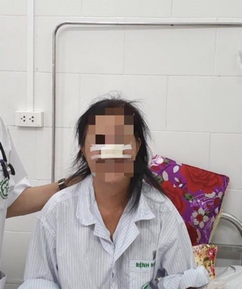 Sức khỏe của nữ bệnh nhân mắc bệnh Whitmore bị ăn mòn cánh mũi giờ ra sao? Suc khoe cua nu benh nhan mac benh Whitmore bi an mon canh mui gio ra sao?