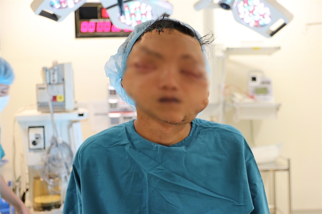 Gần 20 năm làm 'người mặt quỷ’, chàng trai không dám ra đường Gan 20 nam lam 'nguoi mat quy’, chang trai khong dam ra duong