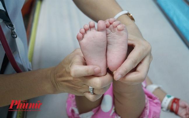 Trẻ bị tay chân miệng nhập viện tăng gấp đôi Tre bi tay chan mieng nhap vien tang gap doi