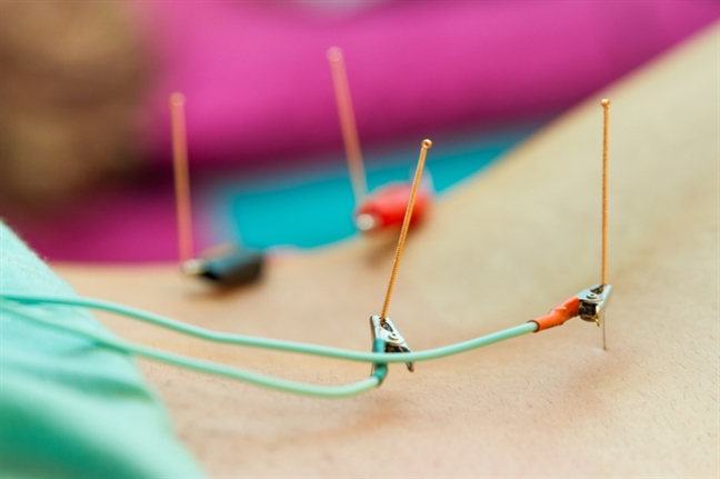 Bác sĩ đông y chỉ cách phẫu thuật thẩm mỹ không cần dùng thuốc tê thuốc mê Bac si dong y chi cach phau thuat tham my khong can dung thuoc te thuoc me