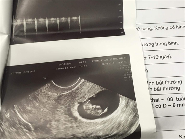 Bệnh viện Thẩm mỹ Emcas hút mỡ bụng cho người mang thai 4 tuần Benh vien Tham my Emcas hut mo bung cho nguoi mang thai 4 tuan
