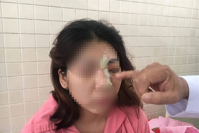 2 phụ nữ bị mù sau khi tiêm filler làm đẹp 2 phu nu bi mu sau khi tiem filler lam dep