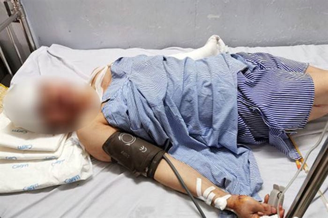 Chém chủ nhà nghỉ trọng thương vì nhờ gọi công an không được Chem chu nha nghi trong thuong vi nho goi cong an khong duoc