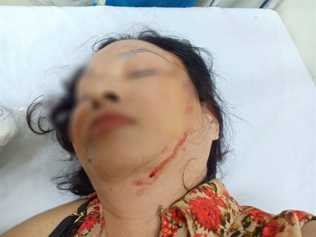 Ly hôn 3 năm, vẫn bị chồng cũ bạo hành thể xác lẫn tinh thần Ly hon 3 nam, van bi chong cu bao hanh the xac lan tinh than