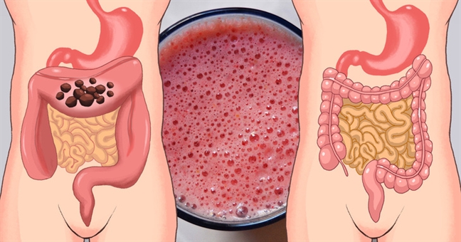 7 phương pháp detox dễ thực hiện 7 phuong phap detox de thuc hien