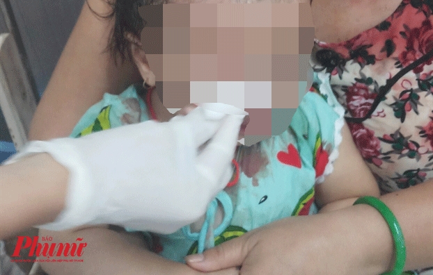 Người hàng xóm vô cớ ném chén thức ăn, bé gái 1 tuổi chấn thương mặt Nguoi hang xom vo co nem chen thuc an, be gai 1 tuoi chan thuong mat