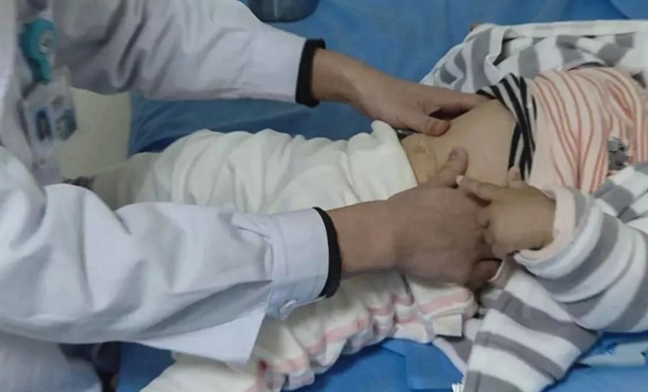 Bé gái 4 tháng tuổi chết do mát xa chữa cảm lạnh Be gai 4 thang tuoi chet do mat xa chua cam lanh